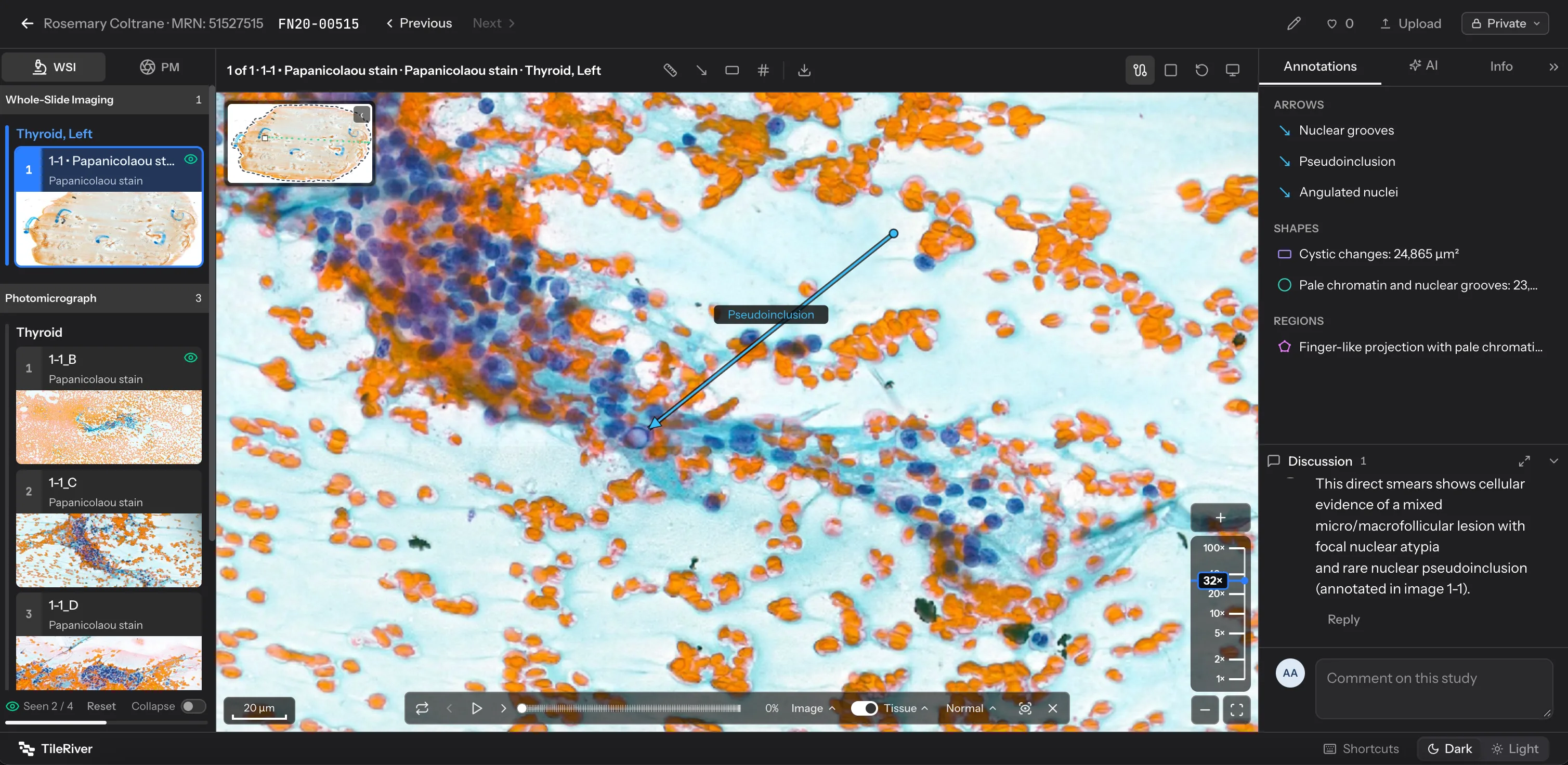 TileRiver Studio viewer
