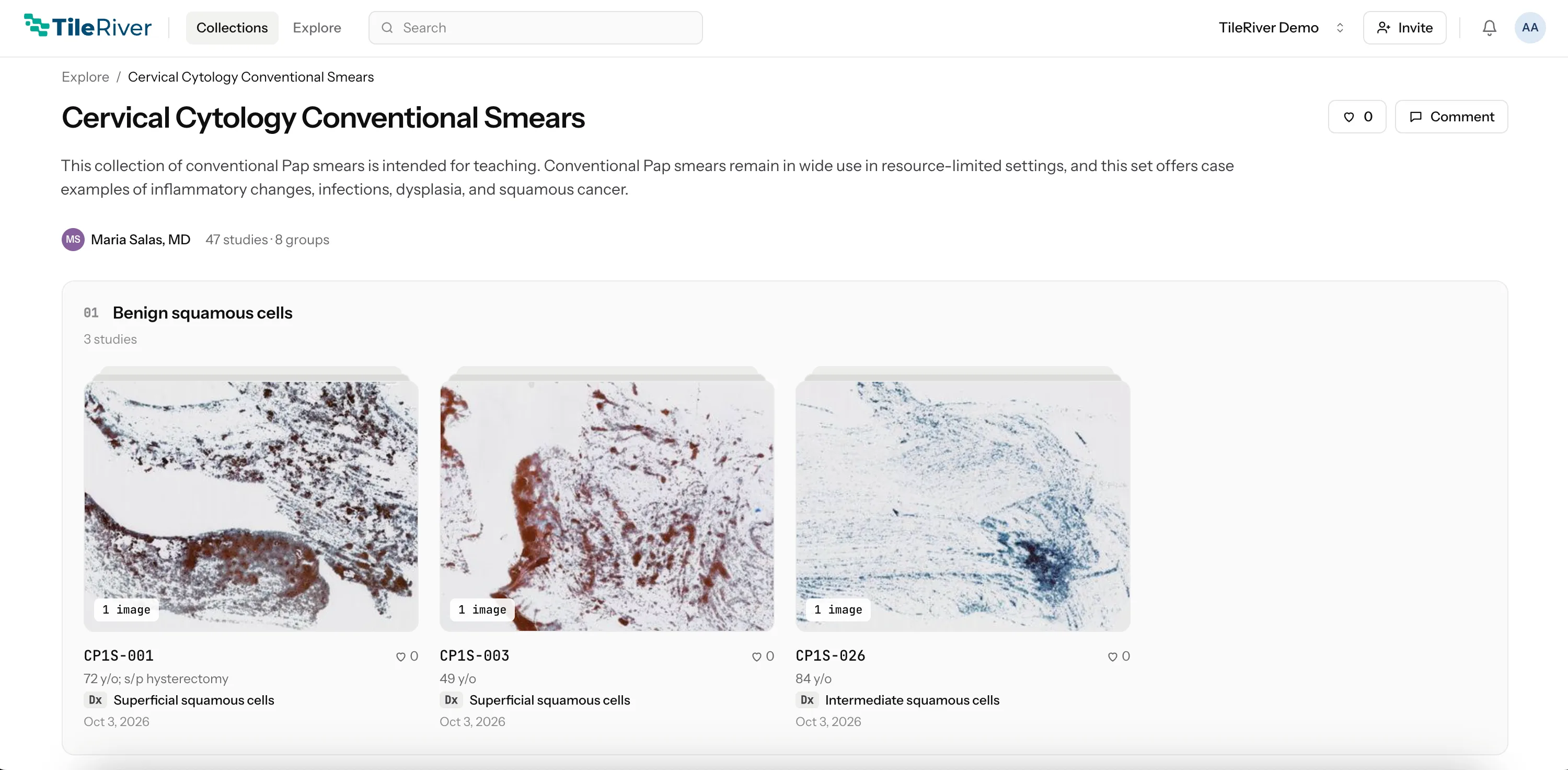 TileRiver Studio collection: Cervical Cytology Conventional Smears